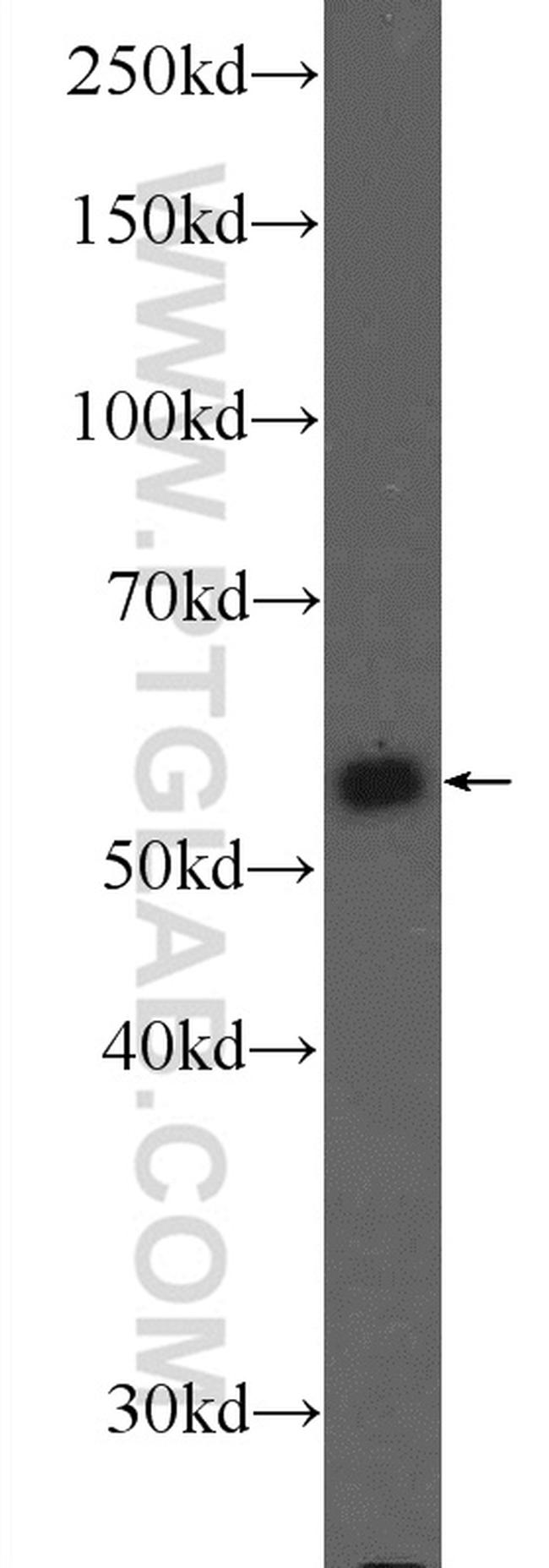 PKM Antibody in Western Blot (WB)