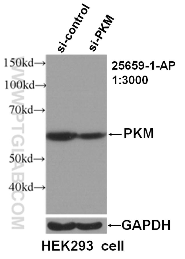 PKM Antibody in Western Blot (WB)