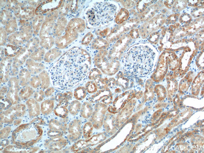 TTC17 Antibody in Immunohistochemistry (Paraffin) (IHC (P))