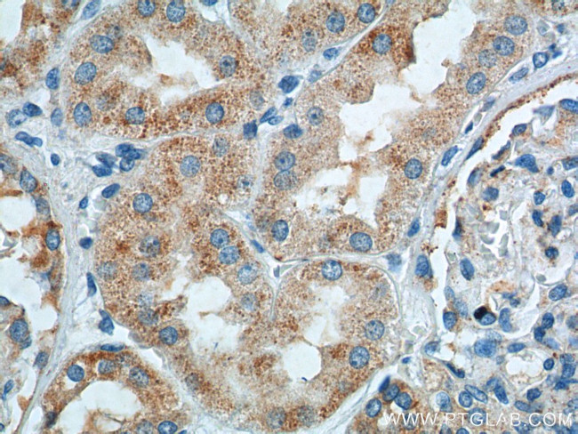 TTC17 Antibody in Immunohistochemistry (Paraffin) (IHC (P))