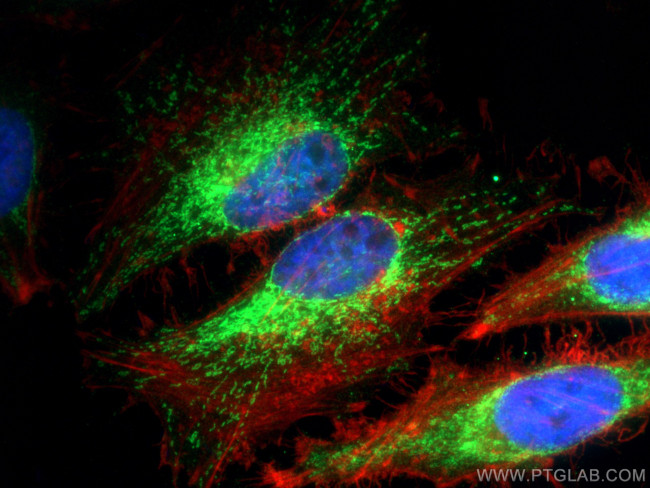 CHCHD10 Antibody in Immunocytochemistry (ICC/IF)