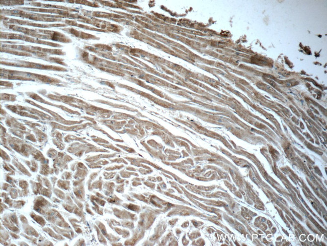 CHCHD10 Antibody in Immunohistochemistry (Paraffin) (IHC (P))