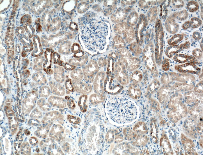 CHCHD10 Antibody in Immunohistochemistry (Paraffin) (IHC (P))