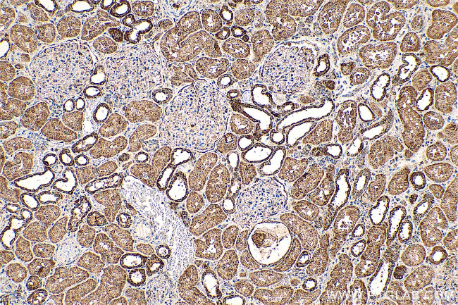 CHCHD10 Antibody in Immunohistochemistry (Paraffin) (IHC (P))