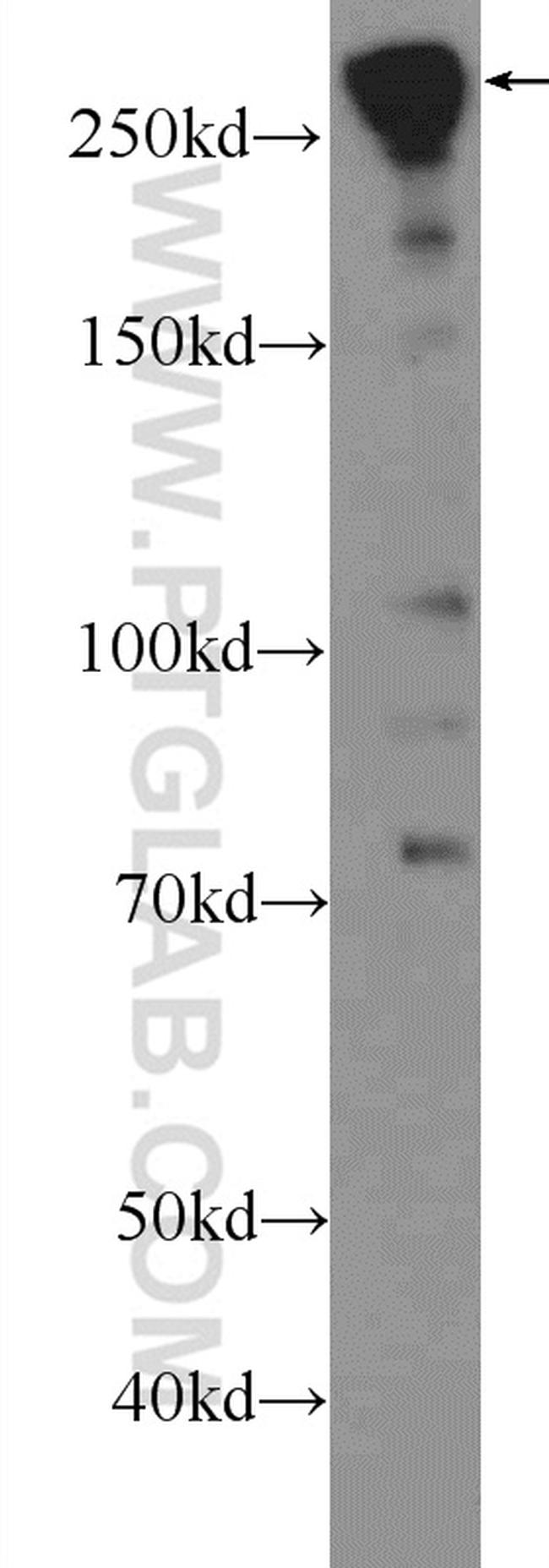 SPTBN1 Antibody in Western Blot (WB)