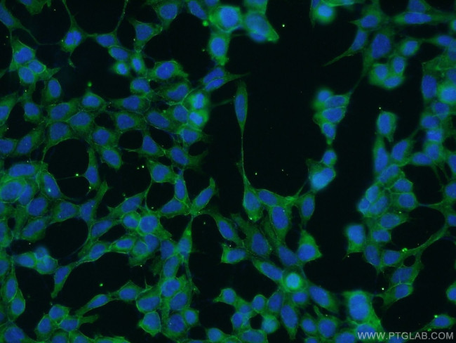 SPTBN1 Antibody in Immunocytochemistry (ICC/IF)