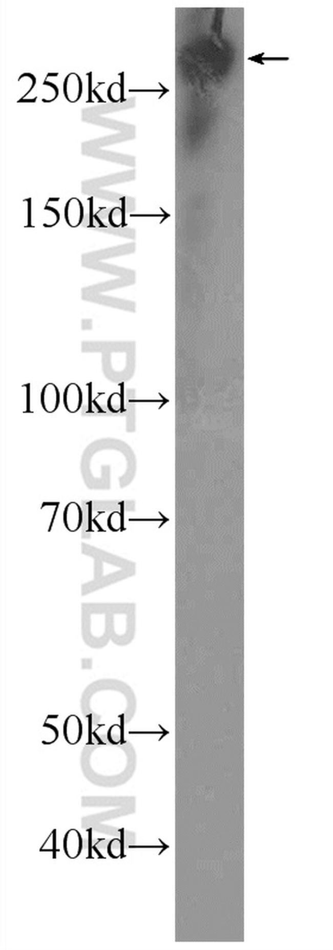 SPTBN1 Antibody in Western Blot (WB)