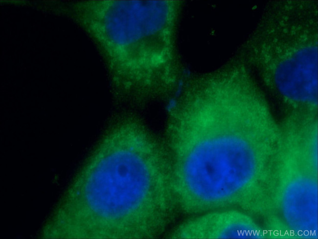 CD63 Antibody in Immunocytochemistry (ICC/IF)