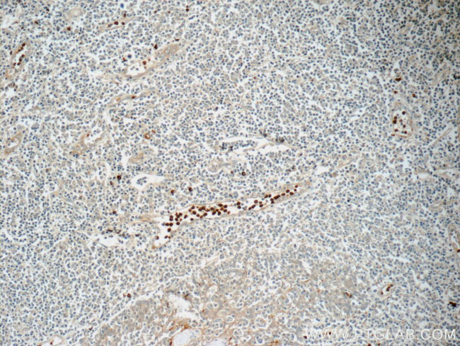 CD63 Antibody in Immunohistochemistry (Paraffin) (IHC (P))