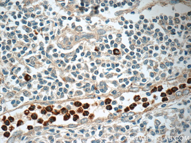 CD63 Antibody in Immunohistochemistry (Paraffin) (IHC (P))