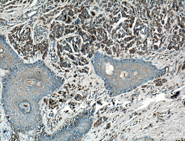 CD63 Antibody in Immunohistochemistry (Paraffin) (IHC (P))