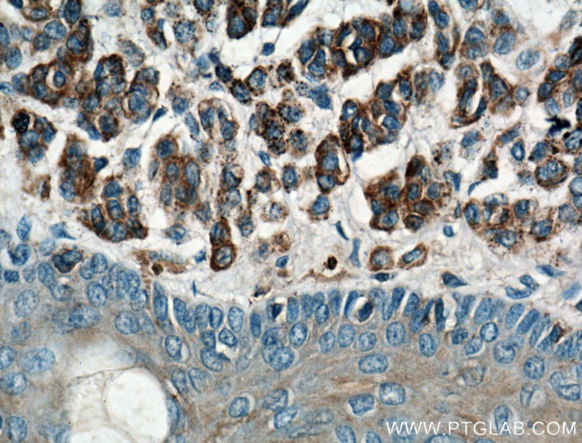 CD63 Antibody in Immunohistochemistry (Paraffin) (IHC (P))