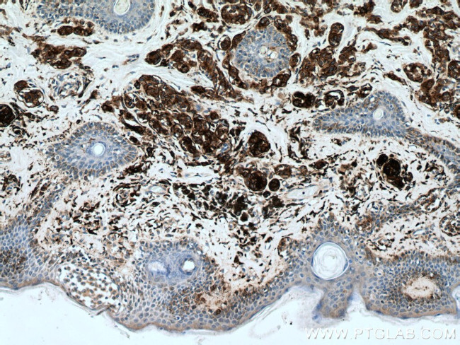 CD63 Antibody in Immunohistochemistry (Paraffin) (IHC (P))