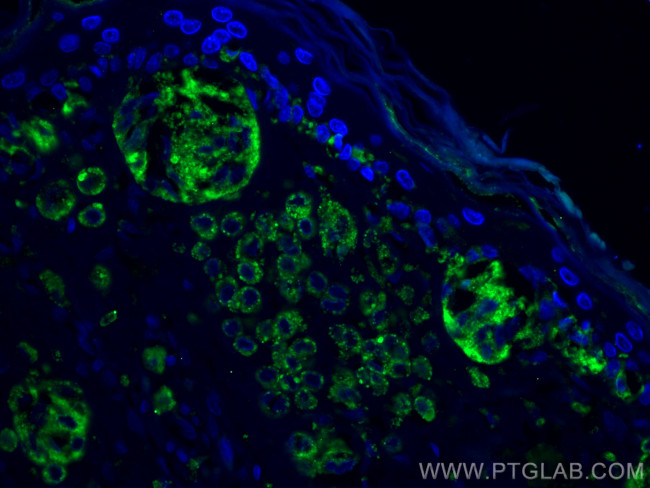 CD63 Antibody in Immunohistochemistry (PFA fixed) (IHC (PFA))