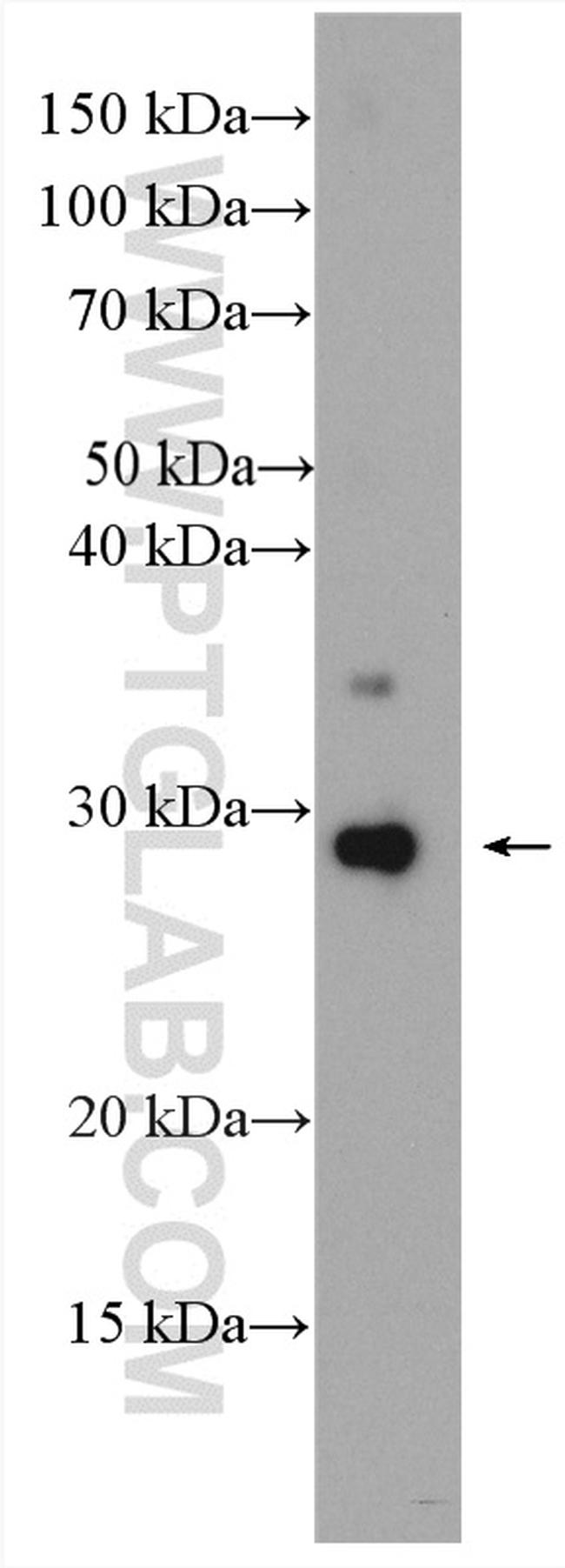 CD63 Antibody in Western Blot (WB)