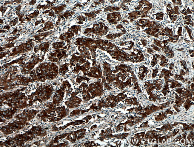 BAIAP2L1 Antibody in Immunohistochemistry (Paraffin) (IHC (P))