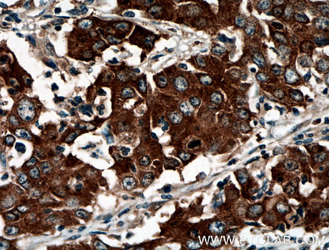 BAIAP2L1 Antibody in Immunohistochemistry (Paraffin) (IHC (P))