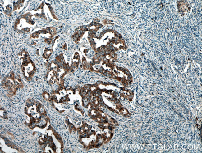 BAIAP2L1 Antibody in Immunohistochemistry (Paraffin) (IHC (P))