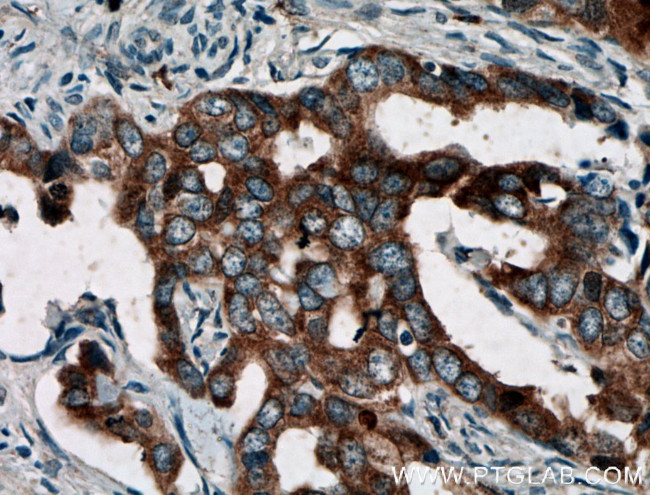 BAIAP2L1 Antibody in Immunohistochemistry (Paraffin) (IHC (P))