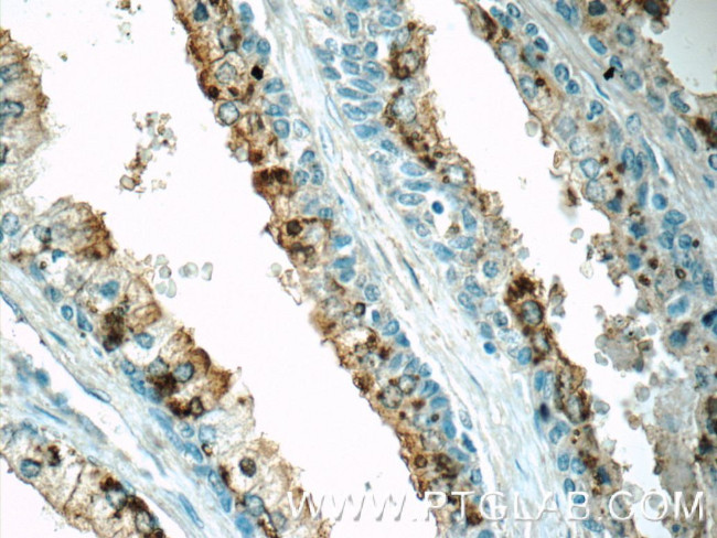 OSGEPL1 Antibody in Immunohistochemistry (Paraffin) (IHC (P))