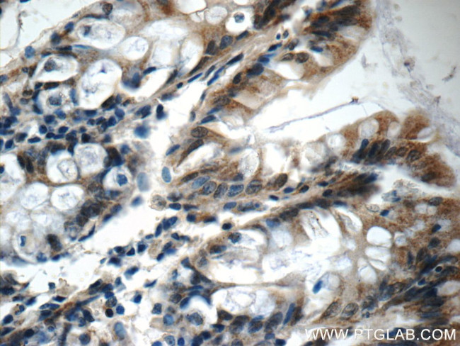 OSGEPL1 Antibody in Immunohistochemistry (Paraffin) (IHC (P))