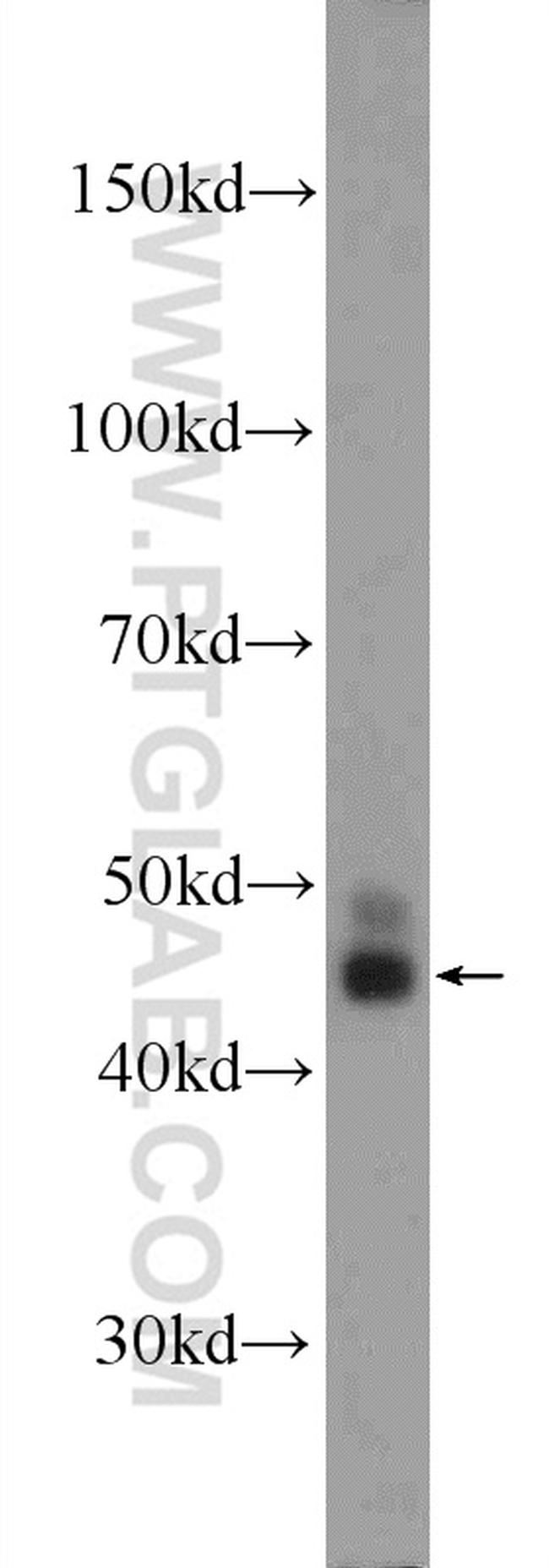 OSGEPL1 Antibody in Western Blot (WB)
