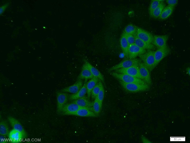 TACC3 Antibody in Immunocytochemistry (ICC/IF)