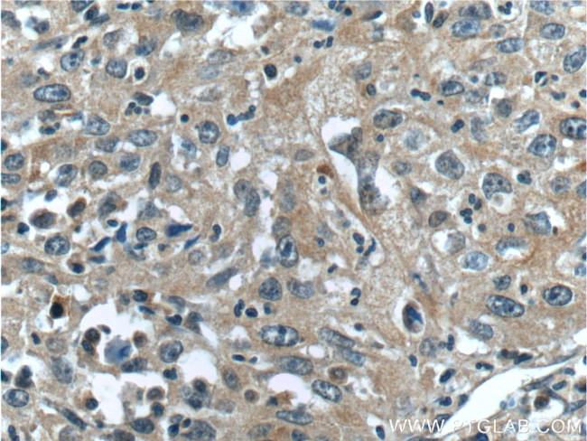 TACC3 Antibody in Immunohistochemistry (Paraffin) (IHC (P))