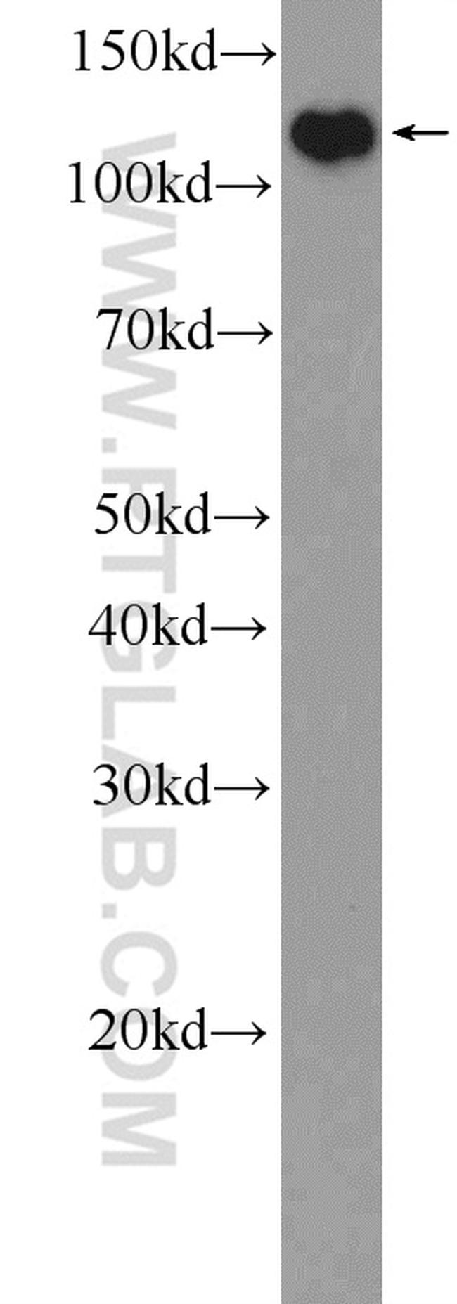 TACC3 Antibody in Western Blot (WB)