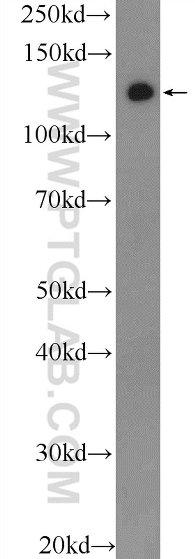 TACC3 Antibody in Western Blot (WB)