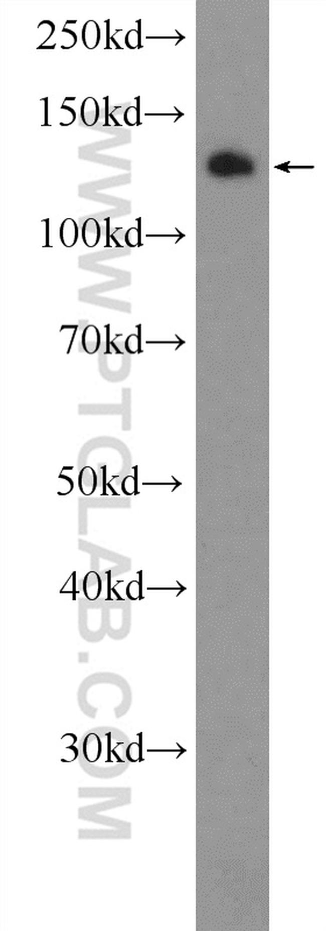 TACC3 Antibody in Western Blot (WB)