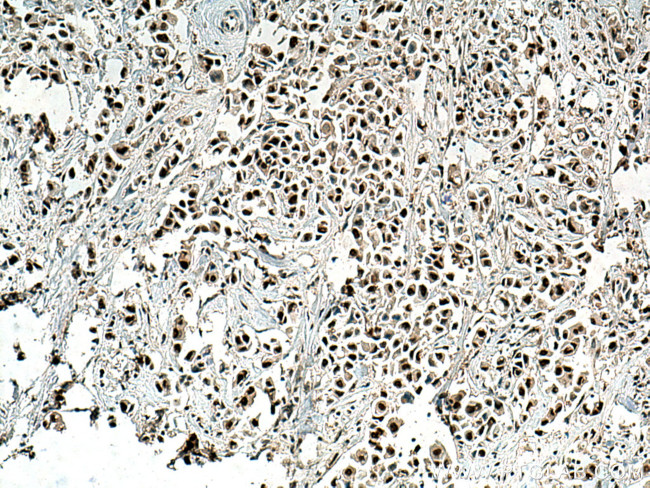 RPUSD2 Antibody in Immunohistochemistry (Paraffin) (IHC (P))