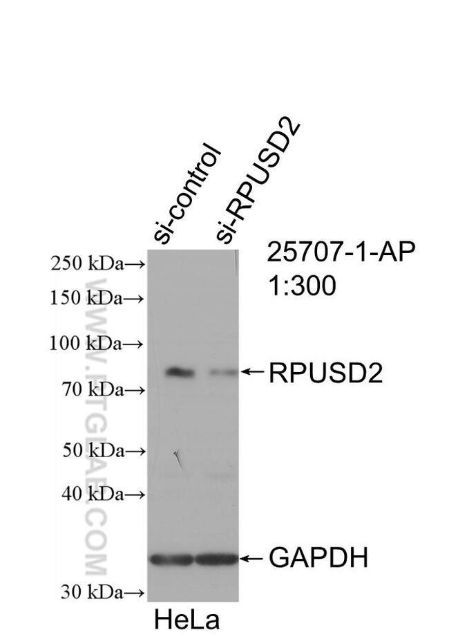 RPUSD2 Antibody in Western Blot (WB)