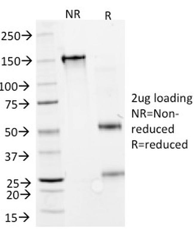 GAD1/GAD67 Antibody in SDS-PAGE (SDS-PAGE)