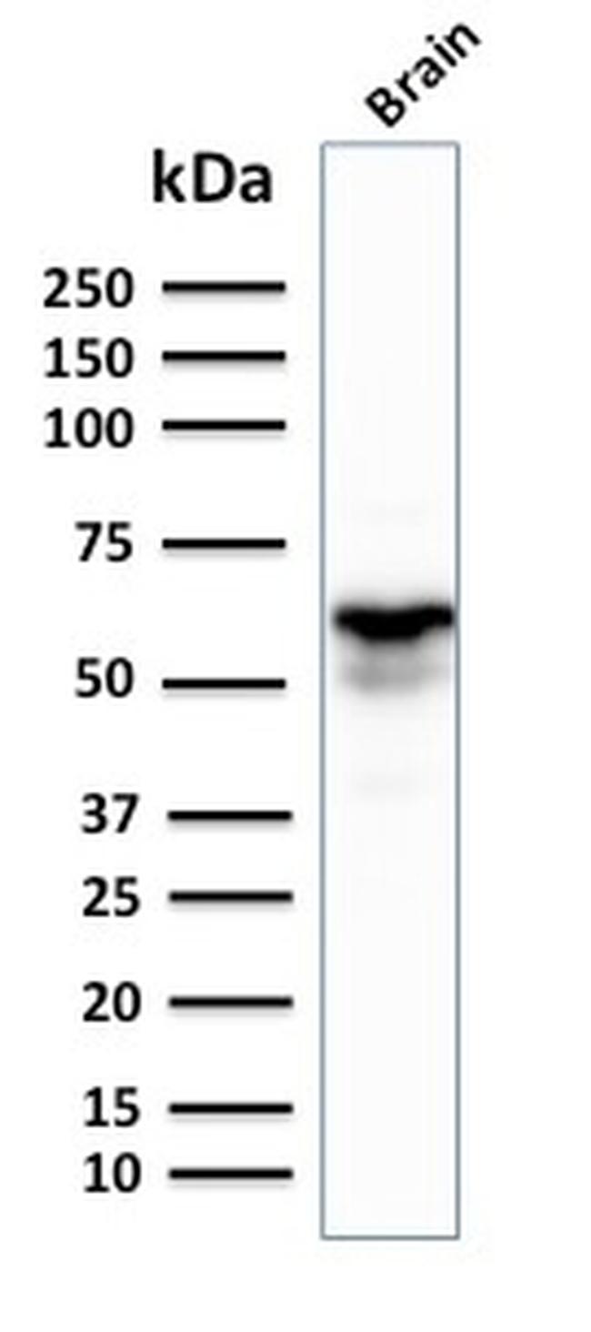 GAD1/GAD67 Antibody in Western Blot (WB)