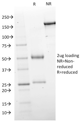 GAD1/GAD67 (GABAergic Neuronal Marker) Antibody in SDS-PAGE (SDS-PAGE)