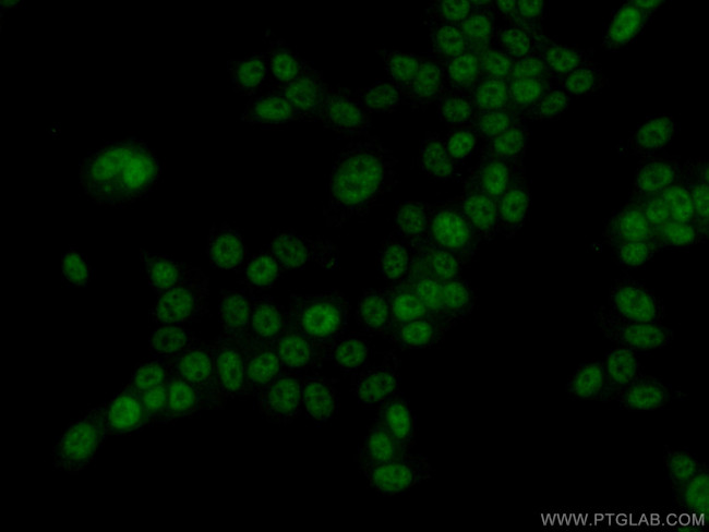 KIAA1429 Antibody in Immunocytochemistry (ICC/IF)