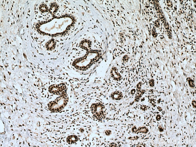 KIAA1429 Antibody in Immunohistochemistry (Paraffin) (IHC (P))