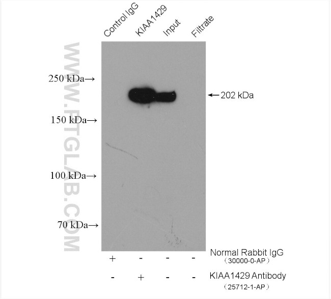 KIAA1429 Antibody in Immunoprecipitation (IP)