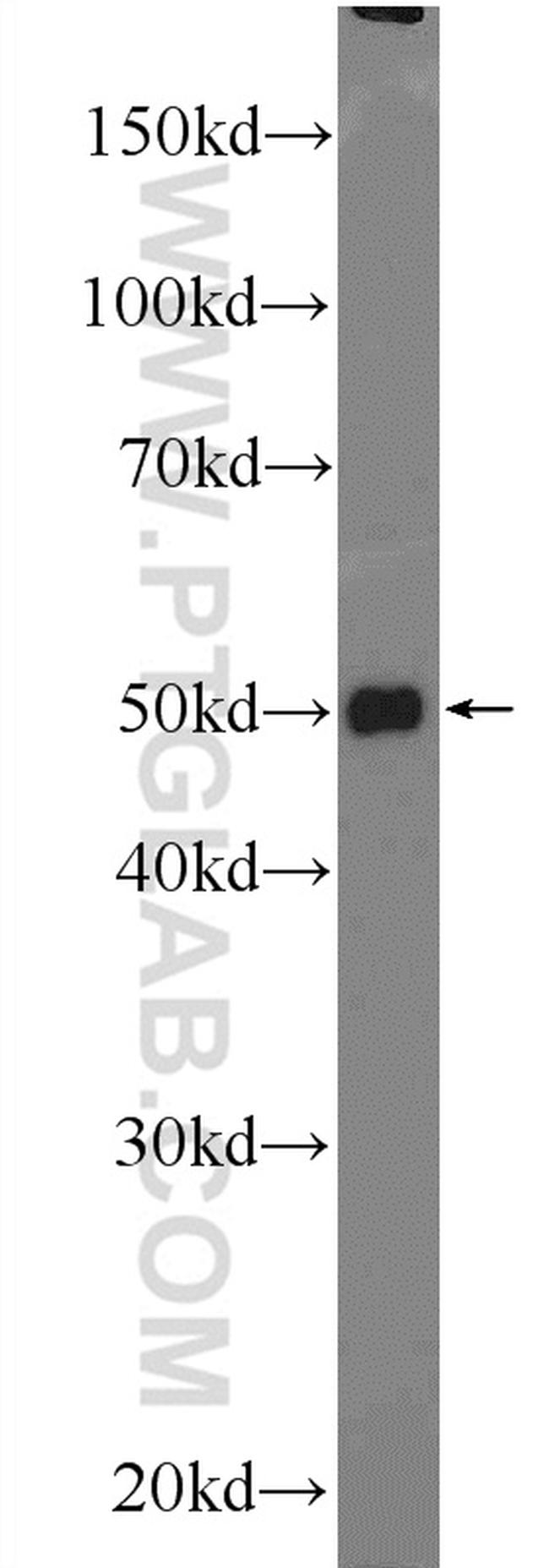 TTC7B Antibody in Western Blot (WB)