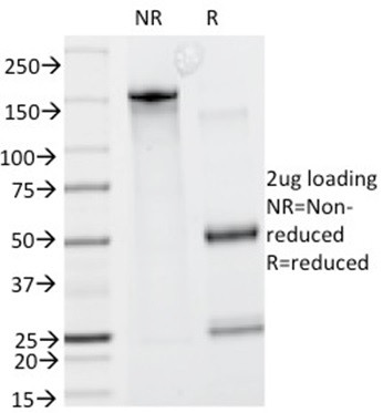 HGAL (Human Germinal Center Associated Lymphoma Marker) Antibody in SDS-PAGE (SDS-PAGE)