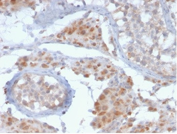 HGAL (Human Germinal Center Associated Lymphoma Marker) Antibody in Immunohistochemistry (Paraffin) (IHC (P))