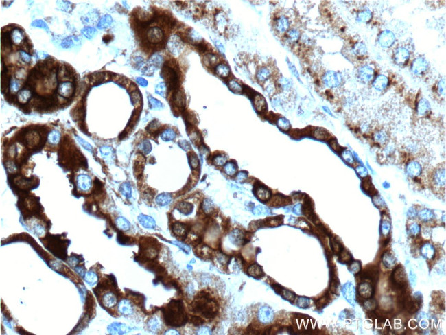 Osteopontin Antibody in Immunohistochemistry (Paraffin) (IHC (P))