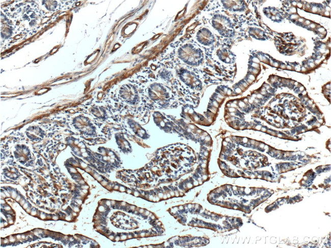 Osteopontin Antibody in Immunohistochemistry (Paraffin) (IHC (P))