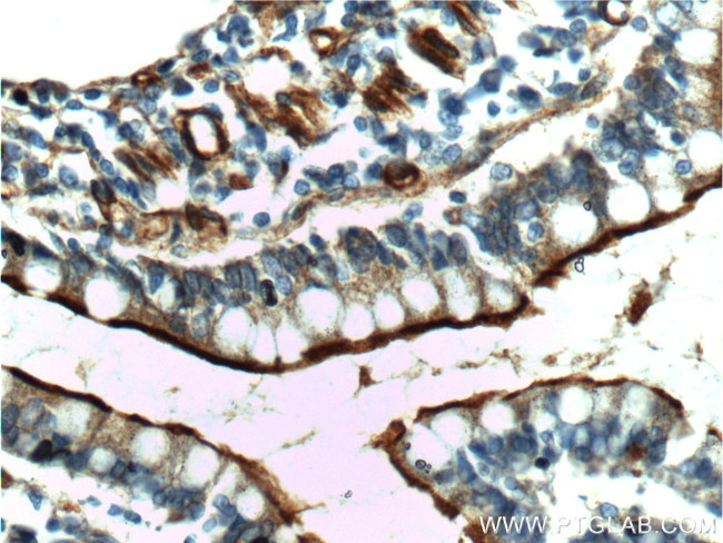 Osteopontin Antibody in Immunohistochemistry (Paraffin) (IHC (P))