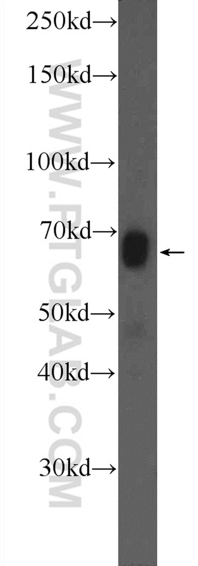 Osteopontin Antibody in Western Blot (WB)