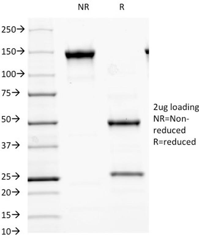 GAD2/GAD65 Antibody in SDS-PAGE (SDS-PAGE)
