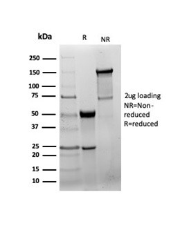 GAD2/GAD65 (GABAergic Neuronal Marker) Antibody in SDS-PAGE (SDS-PAGE)