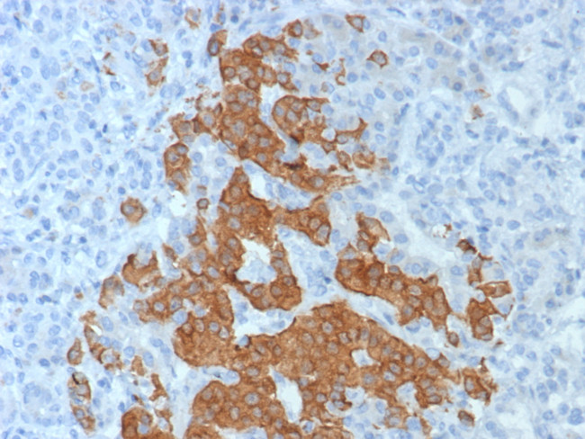 GAD2/GAD65 (GABAergic Neuronal Marker) Antibody in Immunohistochemistry (Paraffin) (IHC (P))