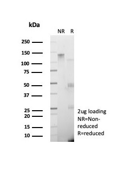 GAD2/GAD65 (GABAergic Neuronal Marker) Antibody in SDS-PAGE (SDS-PAGE)